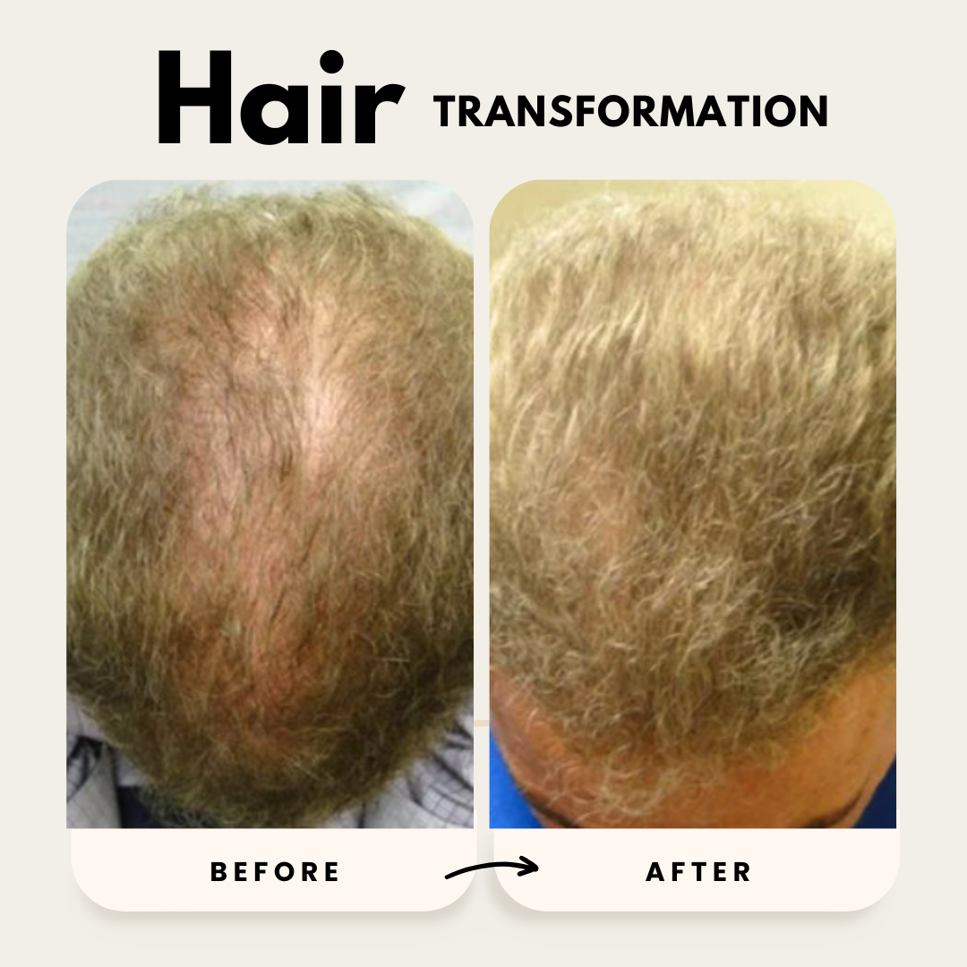Lustrao Hair Growth Trio| Consistency Kit